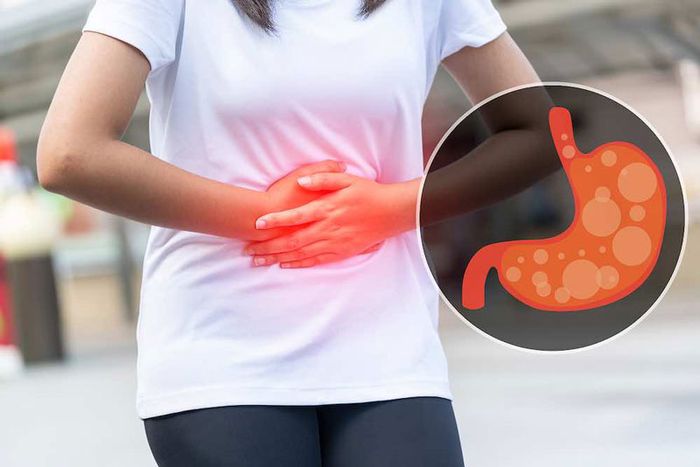Tích tụ axit gây ra việc dạ dày trào ngược