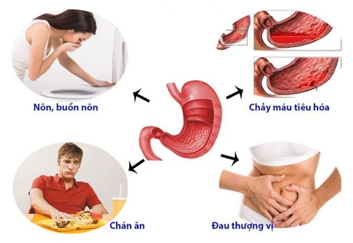 Khi có dấu hiệu đau dạ dày, cần đi khám ngay.