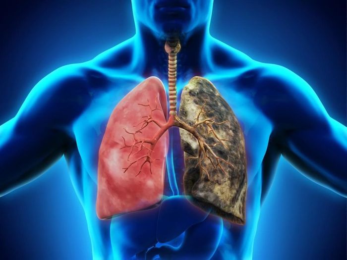 Nấm cũng là một trong những nguyên nhân có thể gây viêm phổi, mặc dù hiếm gặp nhưng thường đi kèm với biến chứng nặng nề và phức tạp hơn so với các nguyên nhân khác. Nấm xâm nhập vào hệ thống hô hấp của con người thông qua tiếp xúc trực tiếp hoặc hít thở không khí chứa bào tử nấm.