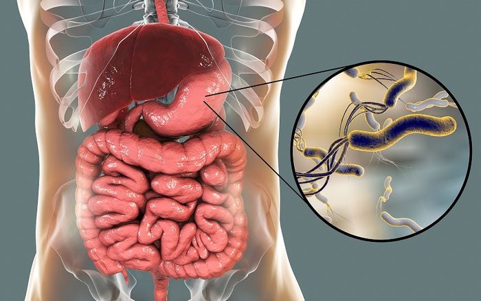 Vi khuẩn HP có khả năng lây nhiễm từ người bệnh sang người lành