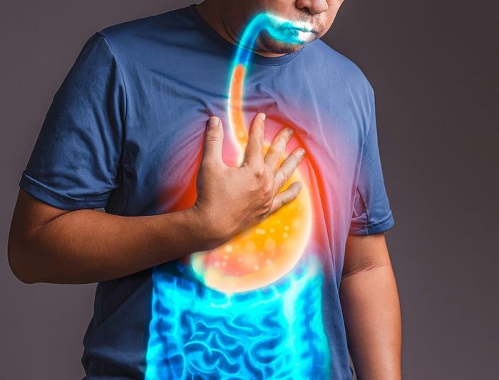  Trào ngược dạ dày là một trong các bệnh lý phổ biến