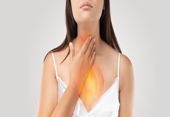 Trào ngược dạ dày có thể gây ra chứng ợ nóng