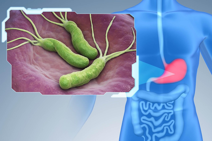 Bệnh viêm dạ dày ruột thường được gây ra chủ yếu bởi vi khuẩn và virus