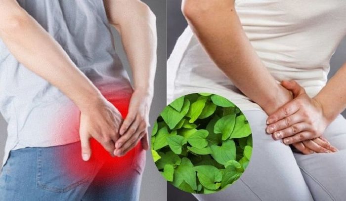 Xông hơi bằng rau diếp cá giúp làm dịu các cơn đau rát hậu môn
