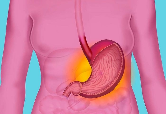 Tỷ lệ mắc các bệnh về dạ dày khá cao