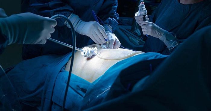 Phẫu thuật ruột thừa là phương pháp chính để điều trị bệnh nhân mắc viêm ruột thừa.