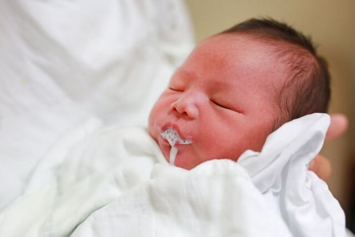 Nôn mửa là dấu hiệu đặc trưng của rối loạn tiêu hóa