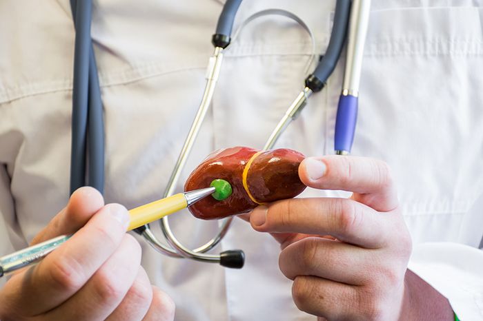 Cắt bỏ túi mật không gây hậu quả vì mật vẫn thực hiện chức năng tiêu hóa của nó.