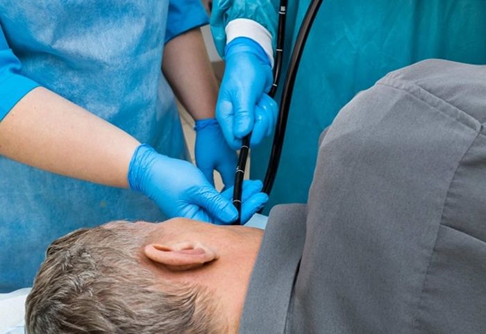 Nội soi thực quản để chẩn đoán bệnh