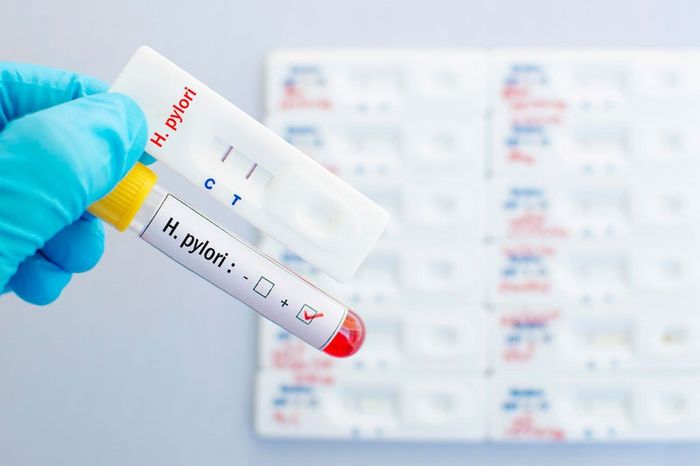 Kiểm tra vi khuẩn HP