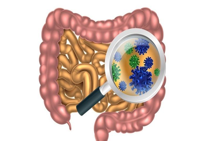 Viêm ruột non có thể do vi sinh vật gây ra
