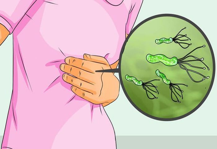Vi khuẩn HP chiếm vị trí hàng đầu trong việc gây ra bệnh viêm loét dạ dày
