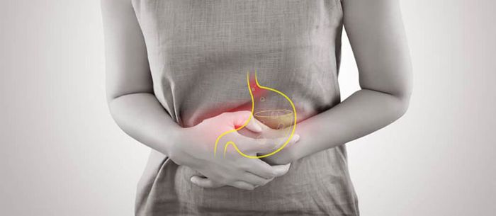 Những thói quen sinh hoạt không lành mạnh là nguyên nhân chính dẫn đến trào ngược dạ dày
