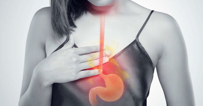 Theo dõi pH thực quản giúp xác định tình trạng bệnh trào ngược dạ dày
