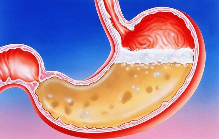 Dịch vị đóng vai trò quan trọng trong quá trình tiêu hóa thức ăn của cơ thể