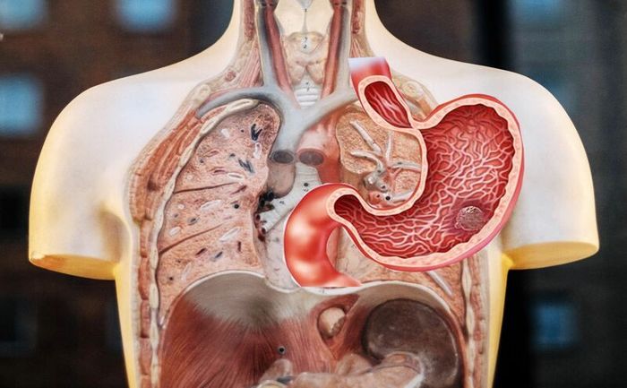 Đề phòng biến chứng ung thư dạ dày từ viêm xung huyết hang vị dạ dày