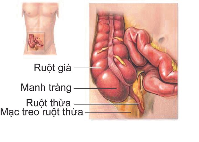 Ruột thừa là một phần nhỏ của đường ruột chứa nhiều vi khuẩn có ích