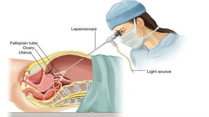 Mô phỏng thực hiện thủ thuật nội soi ổ bụng