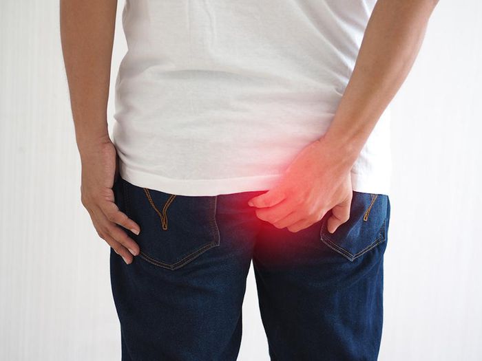 Trĩ gây ra nhiều phiền toái cho người bệnh