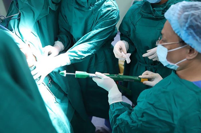 Kỹ thuật cắt trĩ mới nhất bằng PPH