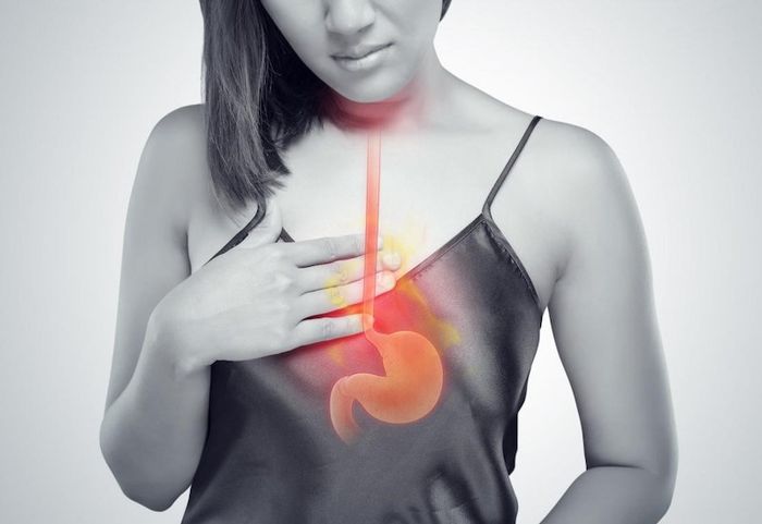 Những người có triệu chứng ợ chua, ợ nóng, ợ hơi cần được siêu âm dạ dày