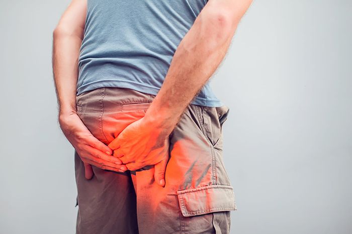 Ai cũng có thể mắc phải bệnh trĩ
