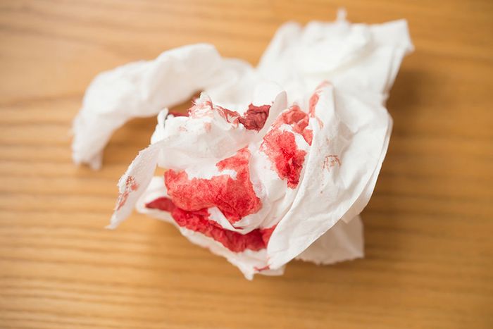 Ra máu khi đi tiêu là một trong những biểu hiện của nứt kẽ hậu môn mà bạn không nên lơ là