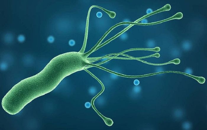 Biến Chứng của Bệnh Viêm Loét Dạ Dày