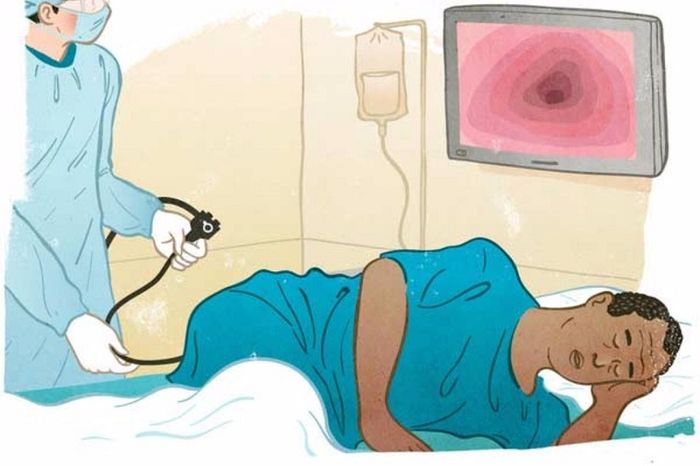 Chuẩn bị như thế nào trước khi thực hiện nội soi đại tràng?