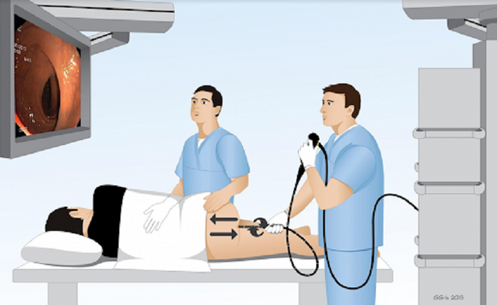 Bác sĩ thực hiện các bước trong quy trình nội soi đại tràng cho bệnh nhân