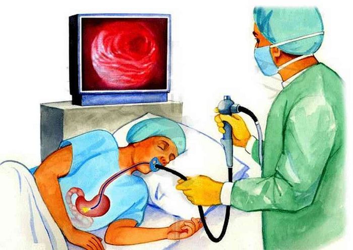 Khám sớm và điều trị viêm thực quản trào ngược là biện pháp phòng tránh ung thư thực quản.