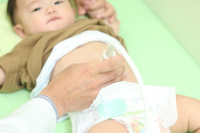 Trẻ có thể mắc tiêu chảy cấp do nhiễm trùng đường tiêu hóa.
