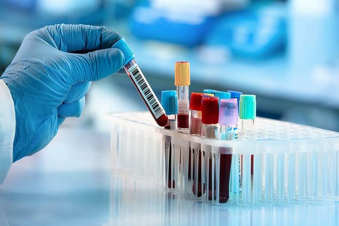 Xét nghiệm máu để phát hiện vi khuẩn Hp