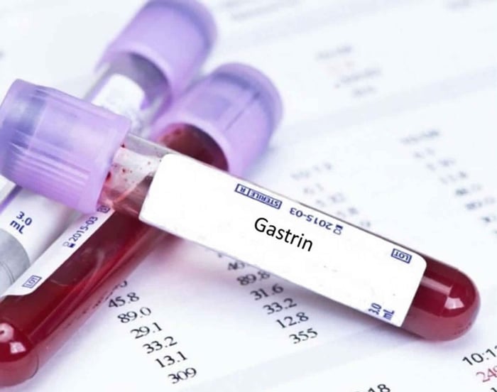 Làm thế nào để kiểm tra nồng độ hormone Gastrin