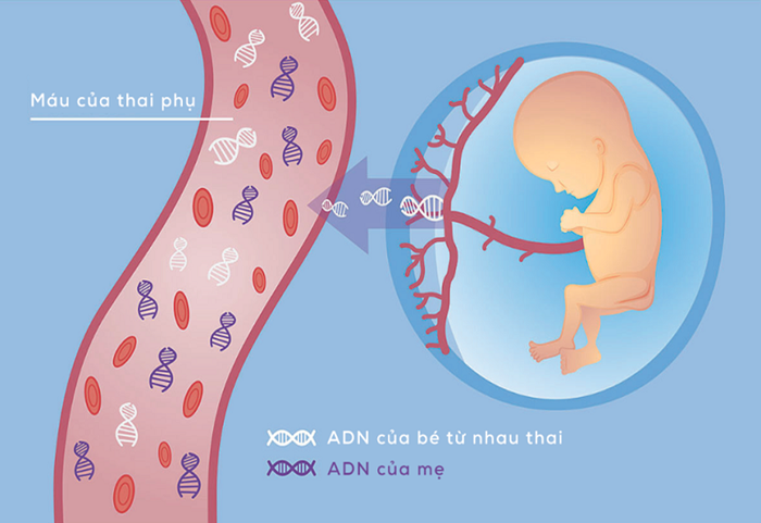 Xét nghiệm NIPT là phương pháp sàng lọc trước sinh rất hiệu quả.