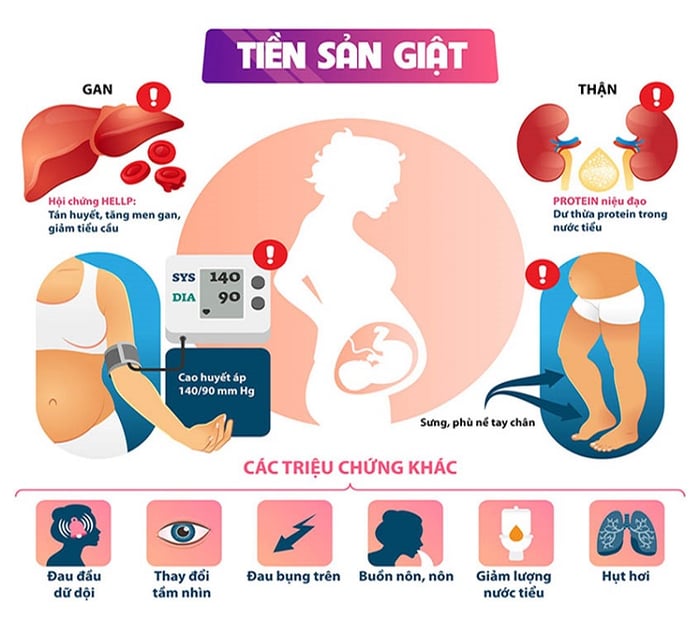 Khái quát về triệu chứng tiền sản giật