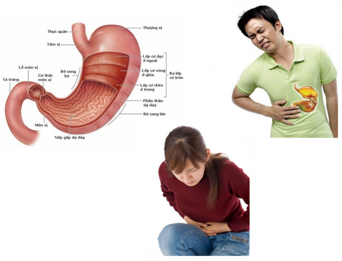 Một trong những vấn đề phổ biến về tiêu hóa là bệnh viêm hang vị dạ dày.