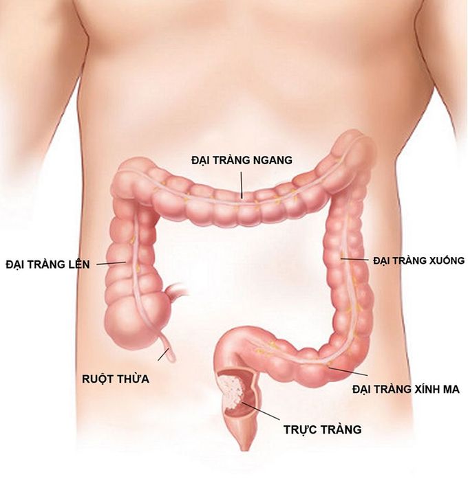 Trực tràng nằm ở đoạn cuối của ruột già nên nội soi có thể thực hiện khá dễ dàng.