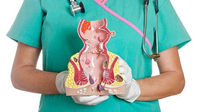 Triệu chứng của trĩ ngoại thường có thể nhìn thấy rõ ràng