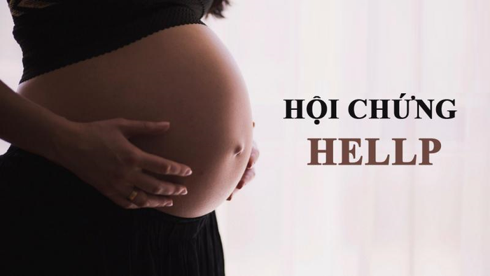 Thai phụ mắc tiền sản giật có nguy cơ cao mắc hội chứng HELLP