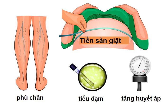 3 dấu hiệu tiền sản giật đặc trưng