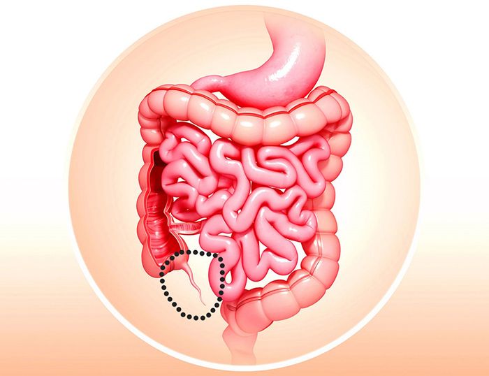 Ruột thừa là một phần của hệ tiêu hóa