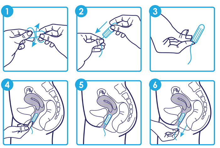 Hướng dẫn chi tiết cách sử dụng tampon.