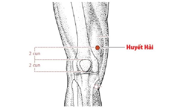 Áp Huyệt Huyết Hải sẽ giúp giảm đau bụng kinh ngay lập tức