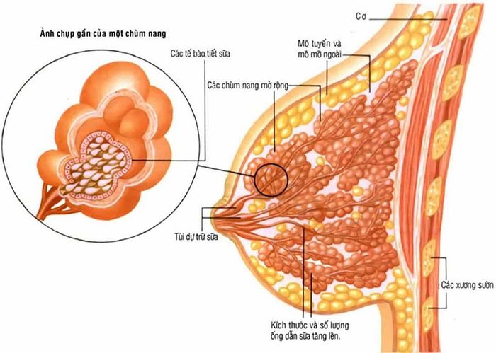 Mô phỏng sự thay đổi cấu trúc mô tuyến vú trong bệnh xơ nang tuyến vú