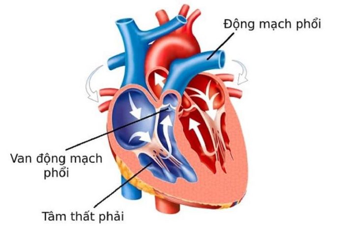 Van động mạch phổi mở, máu được đẩy một chiều từ tâm thất phải vào động mạch chủ