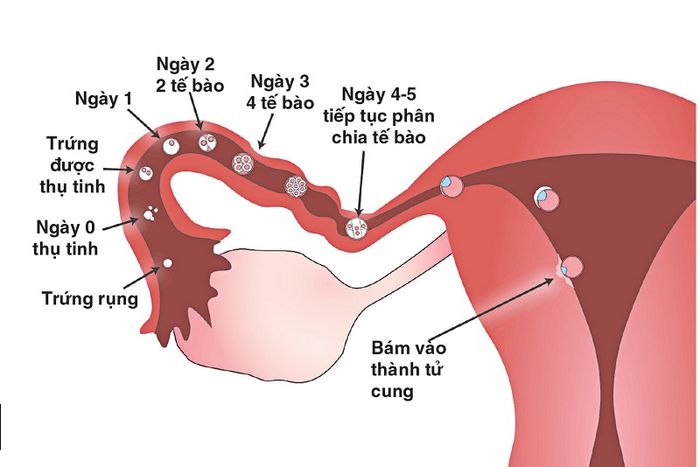 Việc trứng làm tổ trong tử cung có thể gây ra cảm giác căng tức ở bụng khi mang thai 3 tháng đầu