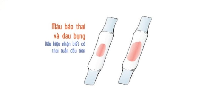 Hiện tượng máu bào thai