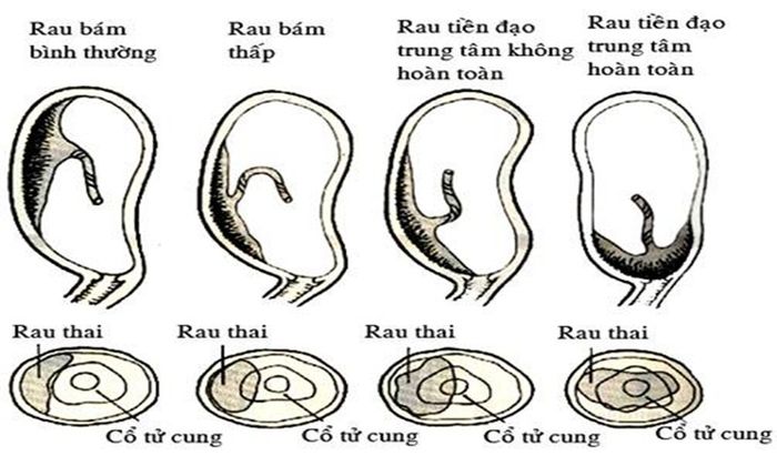 Những điểm đặc biệt và tầm quan trọng của bánh nhau cần được lưu ý