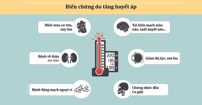 Tăng huyết áp có thể gây ra nhiều biến chứng nguy hiểm.